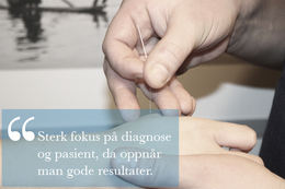 akupunkturbilde