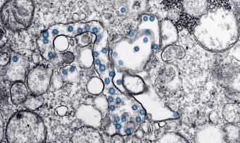 koronavirus oppdatert illustrasjon - SKAL KREDITERES CDC - Hannah A Bullock og Azaibi Tamin